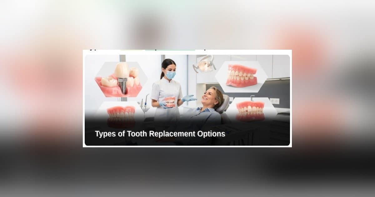 Implantes Dentários Acessíveis: Como Economizar Sem Sacrificar a Qualidade