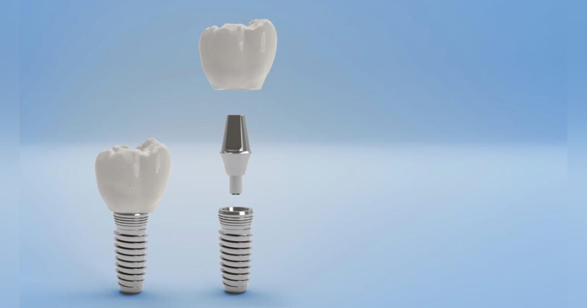 Gunbarrel Dental Center divulga orientações clínicas sobre opções profissionais de clareamento dental