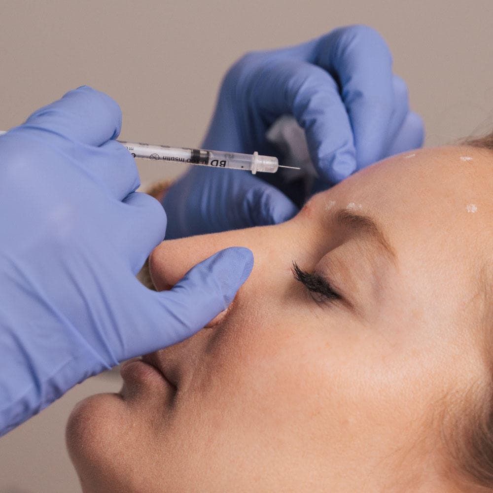 Laser Center of Marin Oferece Tratamentos Abrangentes de Botox em Corte Madera