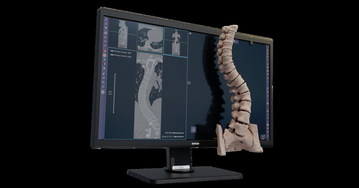 Avatar Medical obtém marcação CE para software de visualização médica 3D sem óculos